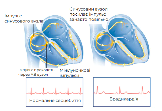 схематичне зображення