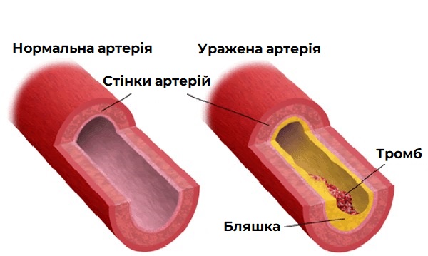 судин