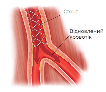 судин